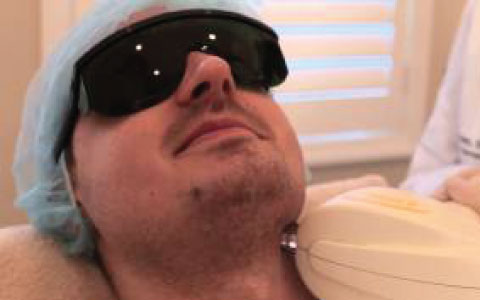 Laser Permanent Hair Removal